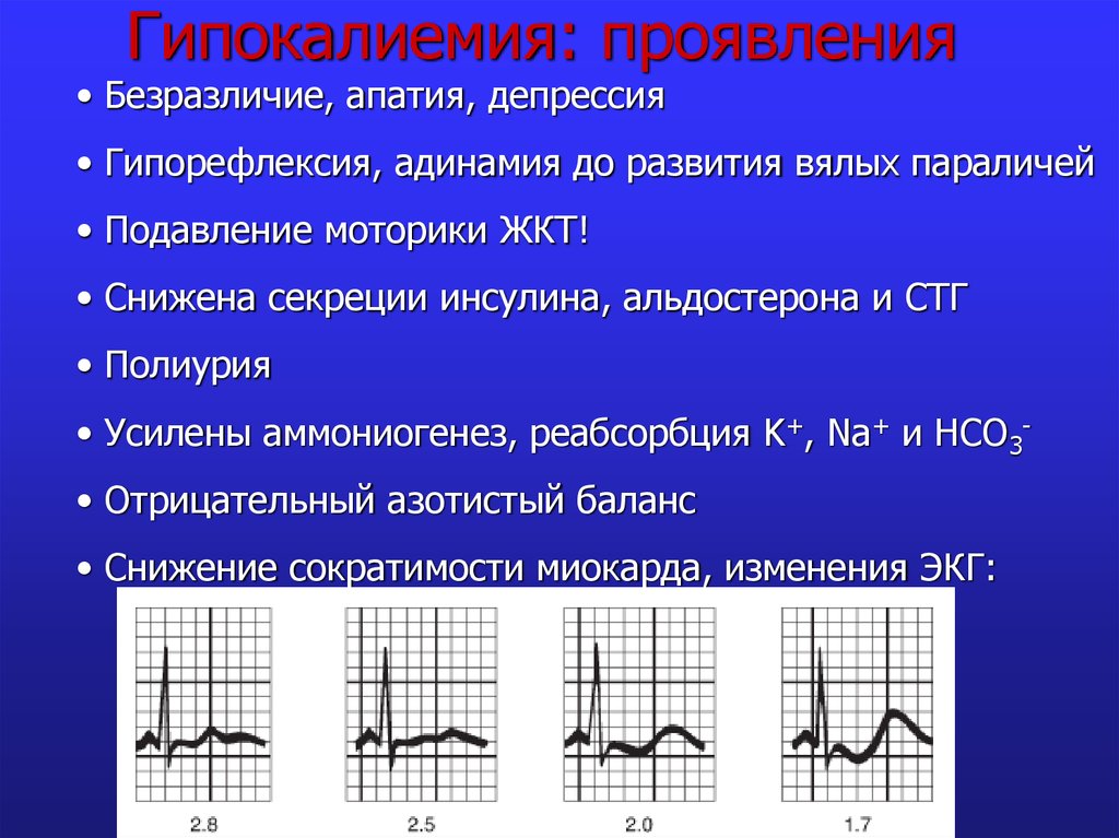 Экг процесс