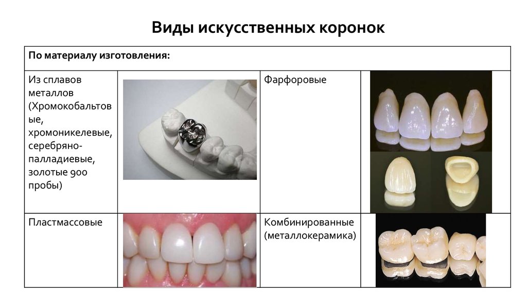 Презентация ортопедия коронки