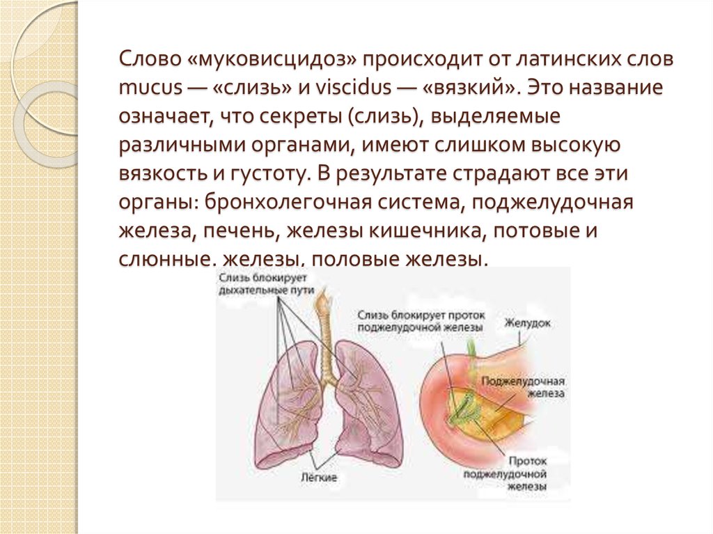 Муковисцидоз что это за заболевание. Патогенез лёгочной формы муковисцидоз. Муковисцидоз бронхолегочная форма. Муковисцидоз кистозный фиброз. Муковисцидоз причины заболевания.