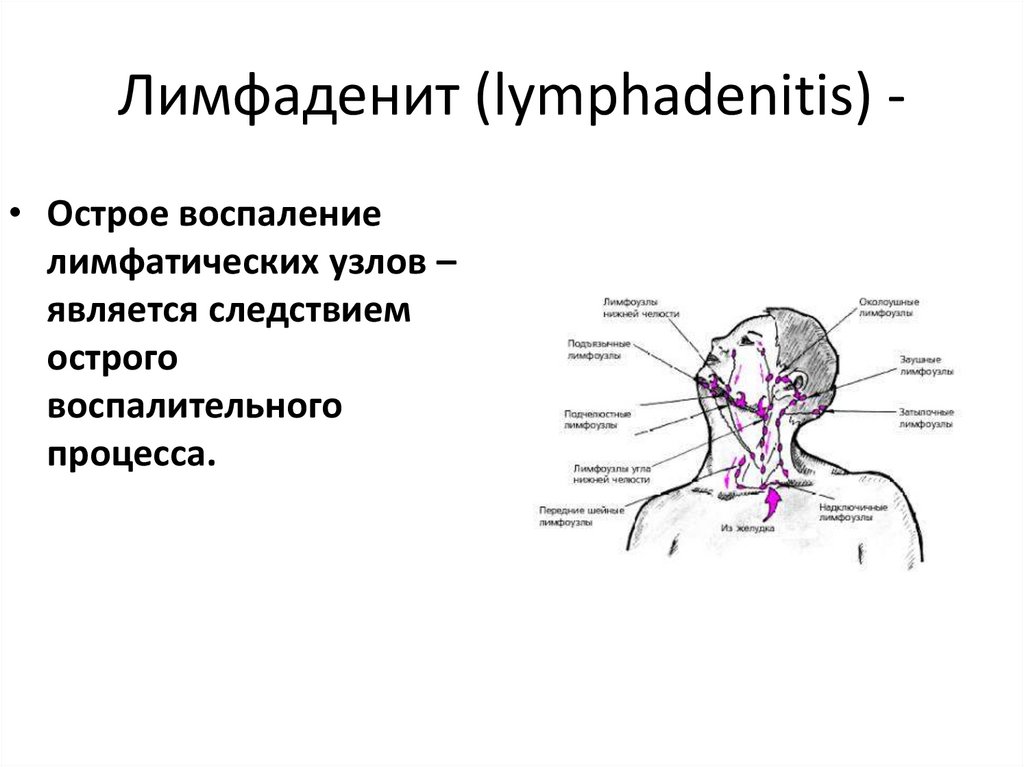 Болезненные лимфатические узлы. Лимфаденит это воспаление лимфатических. Лимфатические узлы шеи кт анатомия. Надключичные лимфоузлы. Регионарные лимфоузлы поднижнечелюстные шейные.