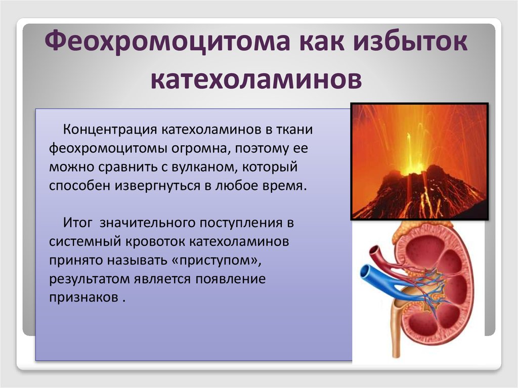 Феохромоцитома. Феохромоцитома клинические проявления. Клиника феохромоцитомы надпочечника. Феохромоцитома надпочечников симптомы. Феохромоцитома презентация.