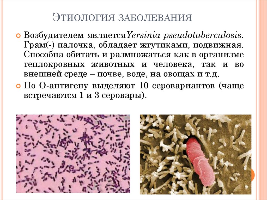 Возбудителем заболевания является