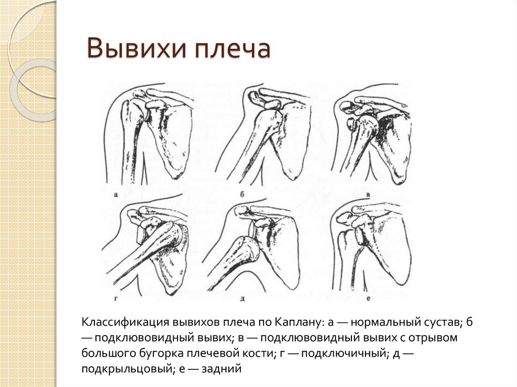 Карман риделя травматология рисунок