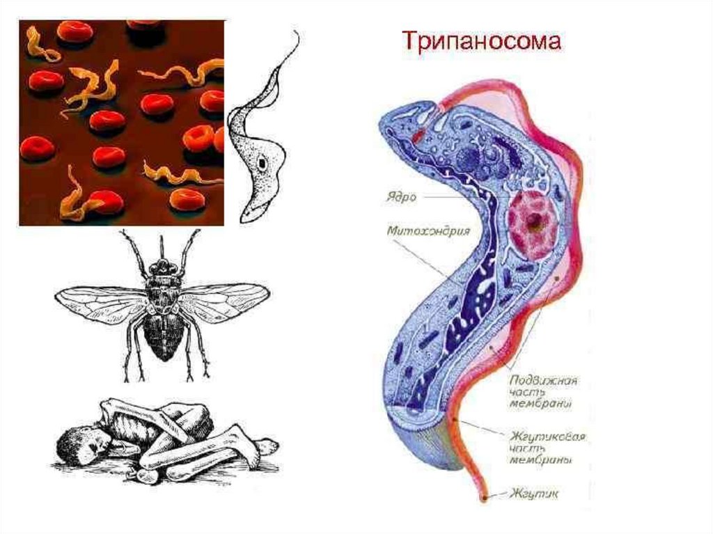 Простейшие в организме человека. Сонная болезнь возбудитель трипаносома. Африканский трипаносомоз строение. Трипаносома Африканская строение. Трипаносома пути заражения.