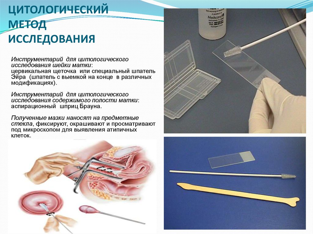 Мазок алгоритм. Цитологический метод исследования в гинекологии. Взятие мазков на цитологическое исследование алгоритм. Методы взятия материала для цитологического исследования. Забор материала на цитологическое исследование.