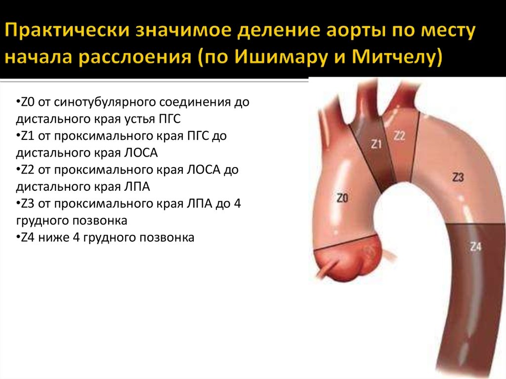 Аневризма восходящей аорты операция