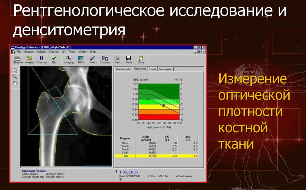 Бесплатная денситометрия. Двухэнергетическая рентгеновская денситометрия. Ультразвуковая денситометрия. Исследование плотности костей денситометрия. Рентгеновская денситометрия костей.