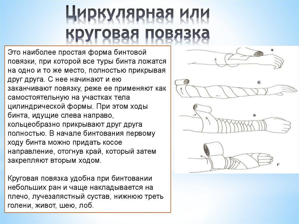 Циркулярная повязка картинка