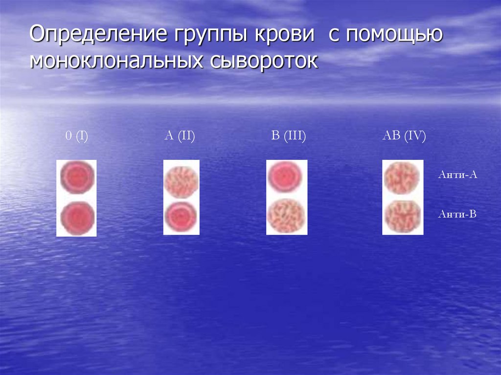 Фенотип группы крови. Резус фенотипирование что это. Определение группы крови.