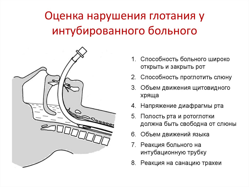 Нарушение глотания