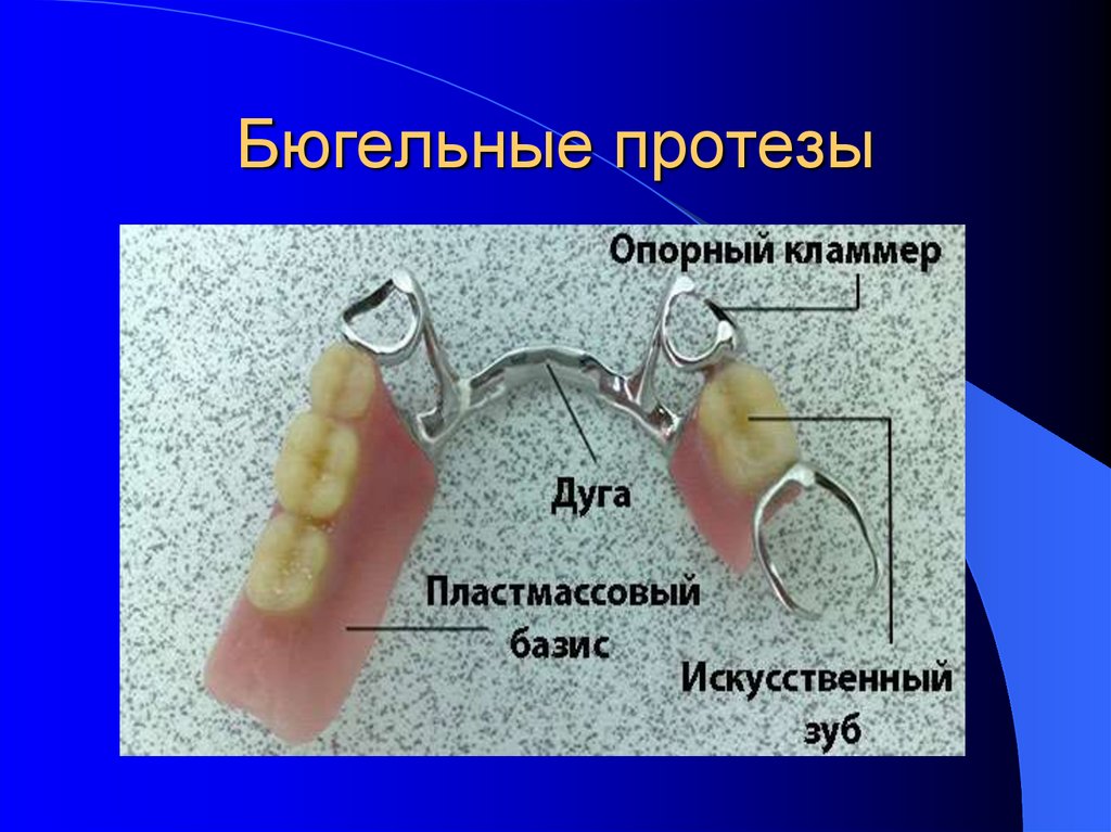 Съемные протезы презентация