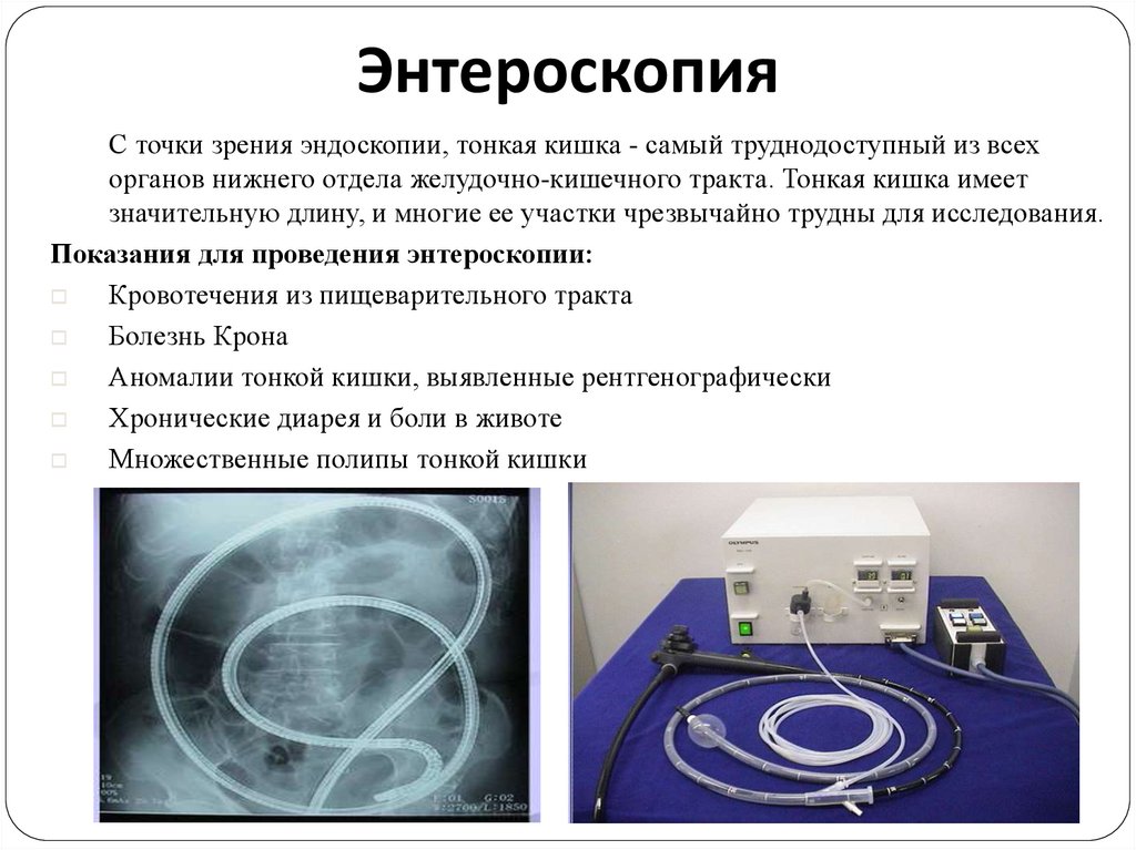 Капсульная эндоскопия презентация