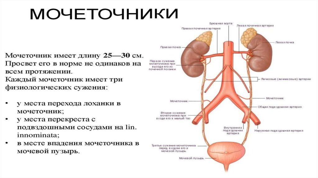 Камень в верхней трети мочеточника