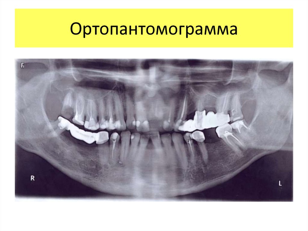 Направление на оптг образец