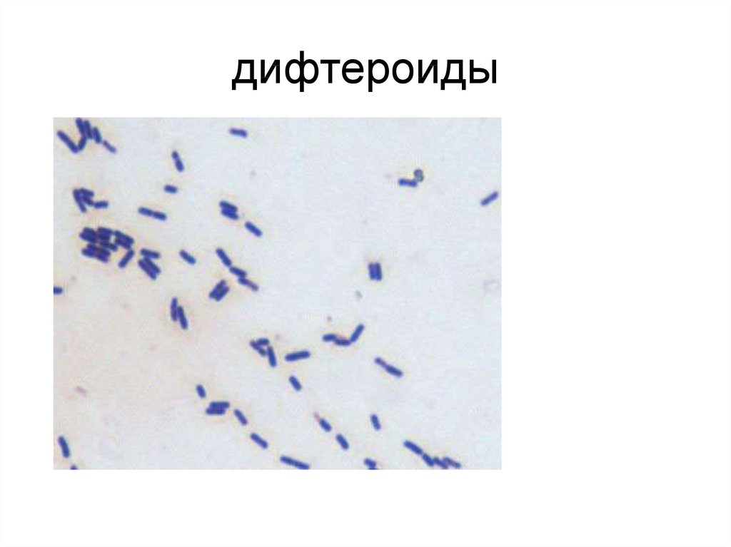Дифтероиды в мазке на флору. Дифтерийная палочка мазок. Коринебактерии дифтероиды. Дифтероиды микроскопия.