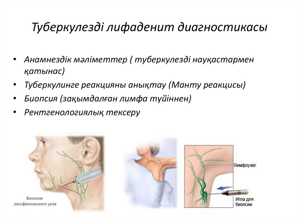 Лимфоузлы увеличены причины