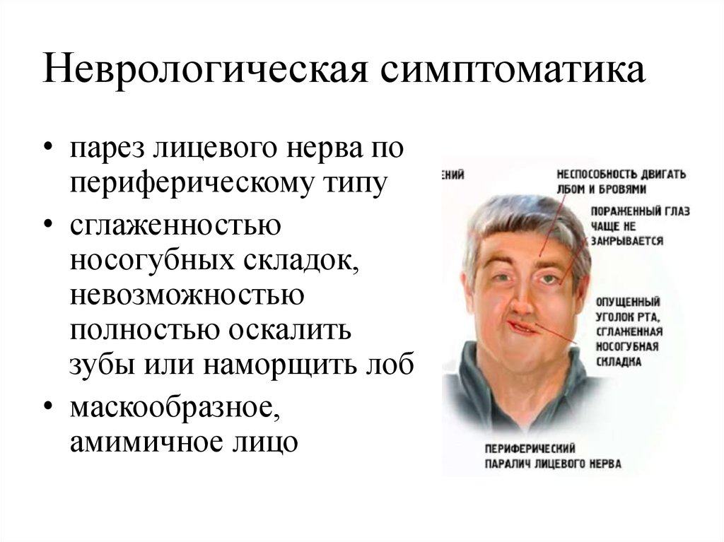 Что такое неврология. Наркологическая симптоматика. Неврологическая симптоматика. Очаговая симптоматика в неврологии. Неврологические симптомы.