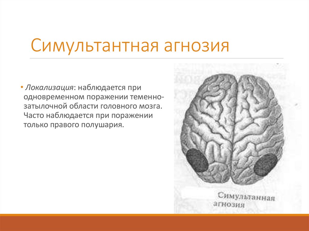 Локализация поражения. Слуховая пространственная агнозия. Симультанная агнозия локализация. Симультанная Зрительная агнозия. Зрительная предметная агнозия локализация.