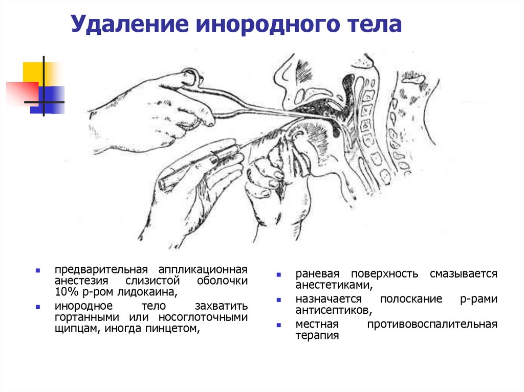 Инородное тело уха карта вызова скорой медицинской помощи