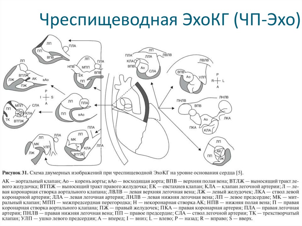 Узи сердца схема