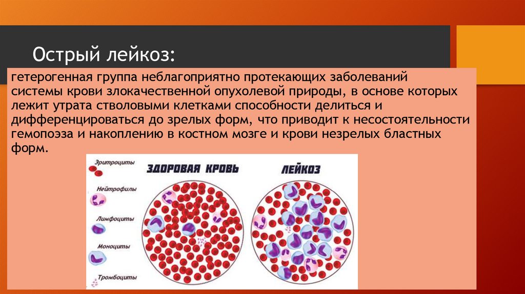 Лейкозы острые и хронические презентация