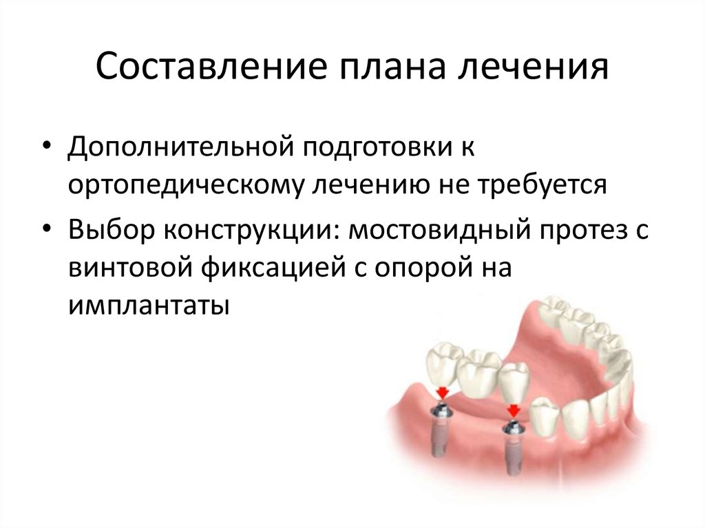 План лечения стоматологического лечения