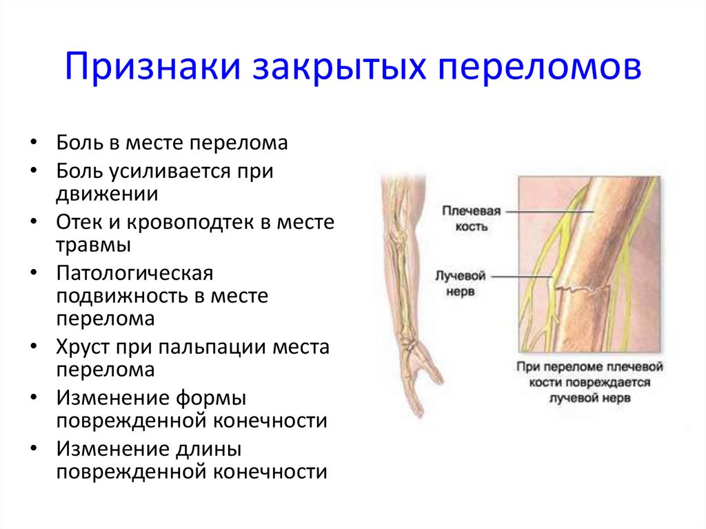 Признаки открытого перелома