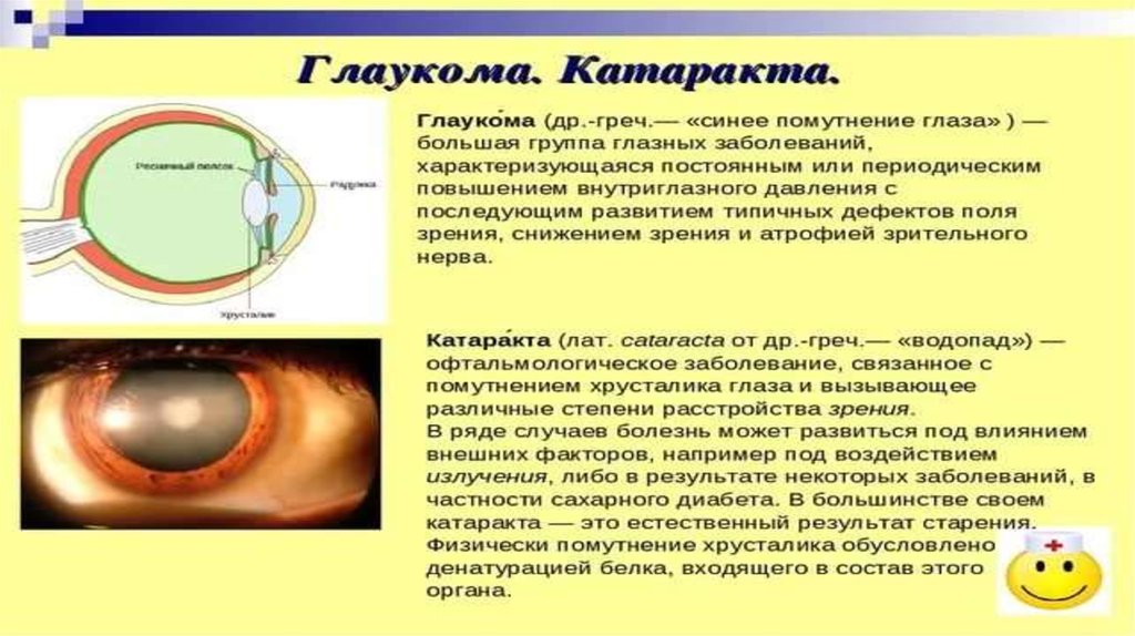 При глаукоме можно применять. Глаукома заболевание хрусталика катаракта. Катаракта – помутнение хрусталика глаза.. Катаракта презентация. Заболевания хрусталика презентация.
