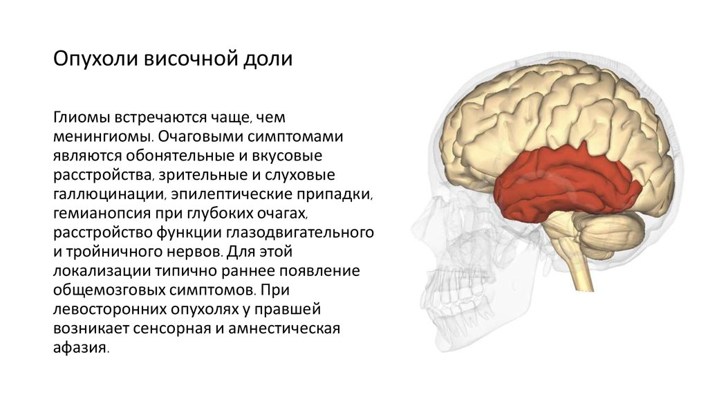 Левая височная. Опухоль бластома головного мозга лобной доли. Объемные образования височной доли. Опухоль правой височной доли.