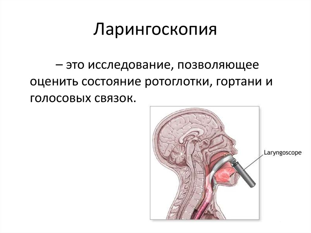 Фарингоскопия