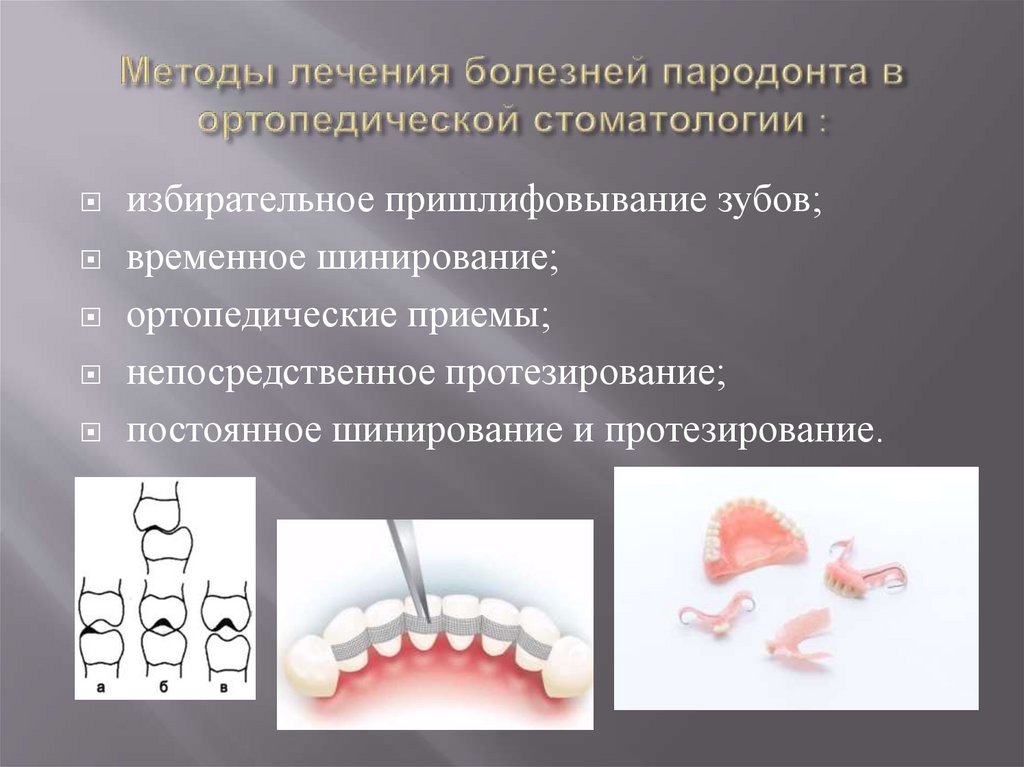 План подготовки к протезированию полости рта