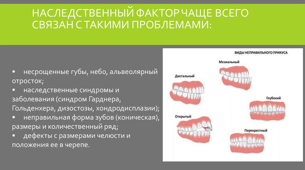 Прикус это. Наследственные аномалии зубочелюстной системы. Генетические факторы зубочелюстных аномалий.