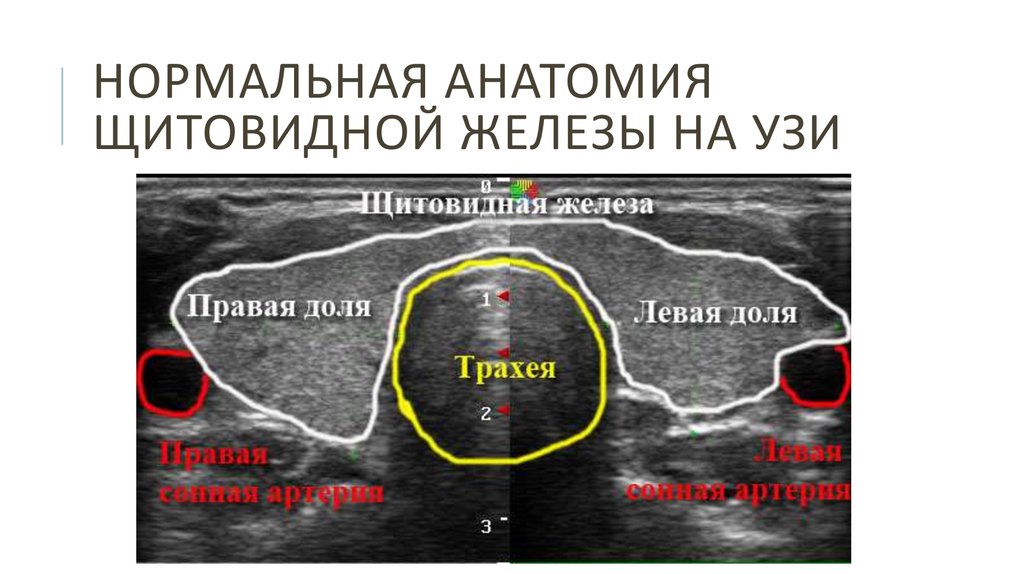 Исследование щитовидной железы. Ультразвуковая анатомия паращитовидных желез. Анатомия щитовидной железы на УЗИ. Паращитовидные железы анатомия на УЗИ. Строение щитовидной железы по УЗИ.