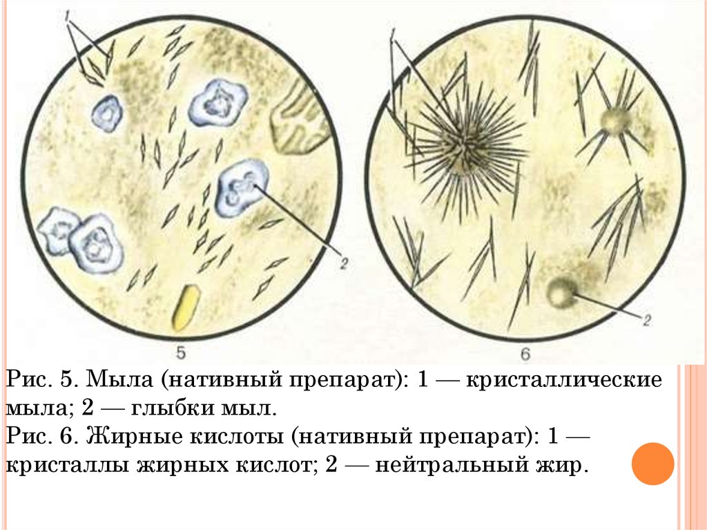 Соли кислой мочи фото