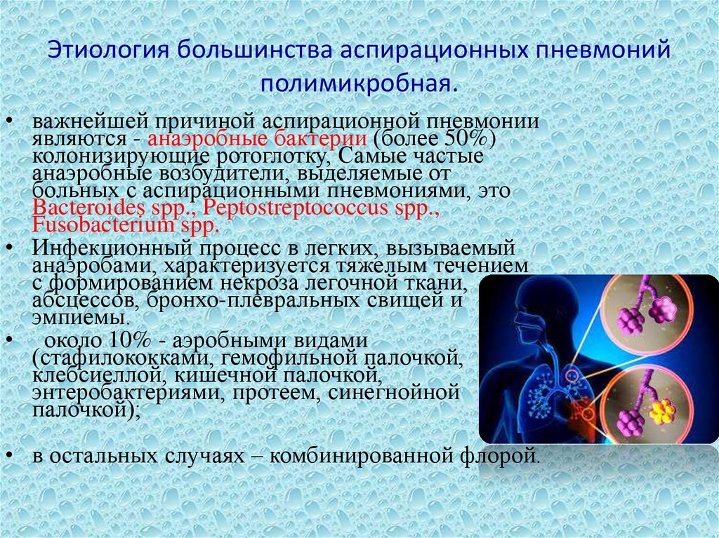 Аспирационная пневмония. Аспирационная пневмония этиология. Причины аспирационной пневмонии. Профилактика аспирационной пневмонии. Аспирационная пневмония возбудители.