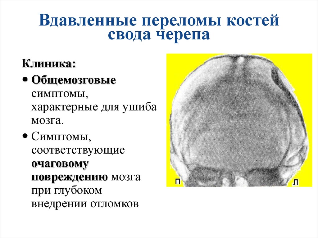 Карта вызова смп перелом основания черепа