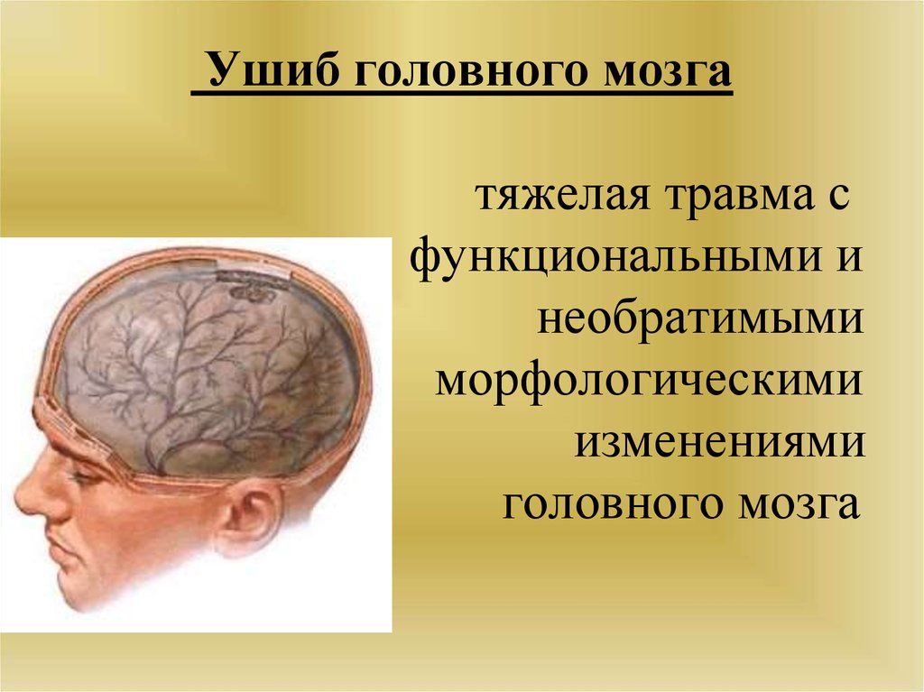 Болезни мозга названия. Заболевания в голове название. Признаком ушиба мозга является:.