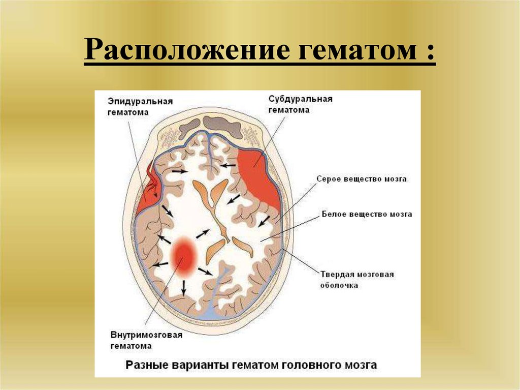 Как долго выходит гематома