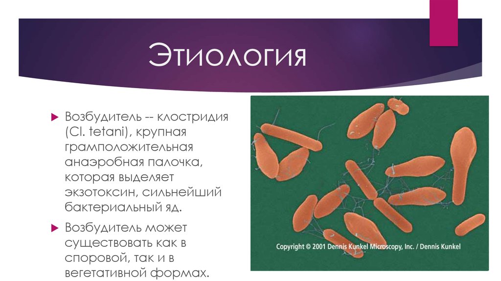 Возбудитель столбняка. Столбнячная палочка Clostridium tetani. Клосьридиум титани возбудитель. Столбняк клостридии формы.