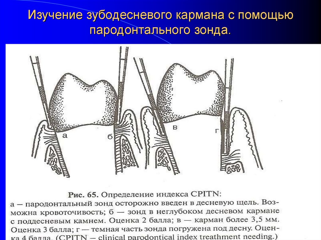 Подвижность зубов презентация