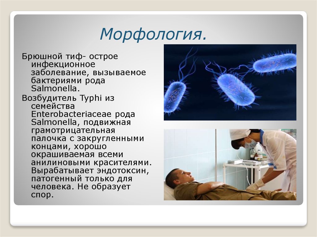 Возбудители инфекционных заболеваний. Морфология возбудителя брюшного тифа. Брюшной тиф возбудитель бактерия. Морфология бактерий брюшного тифа. Брюшной тиф морфология.