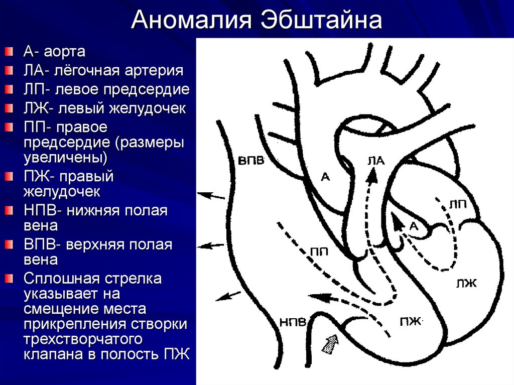 Вид легочной артерии