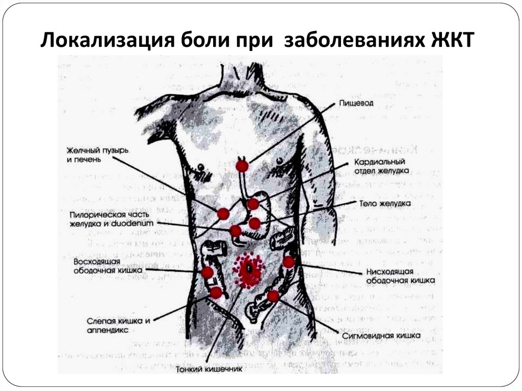 Определить что болит по картинке