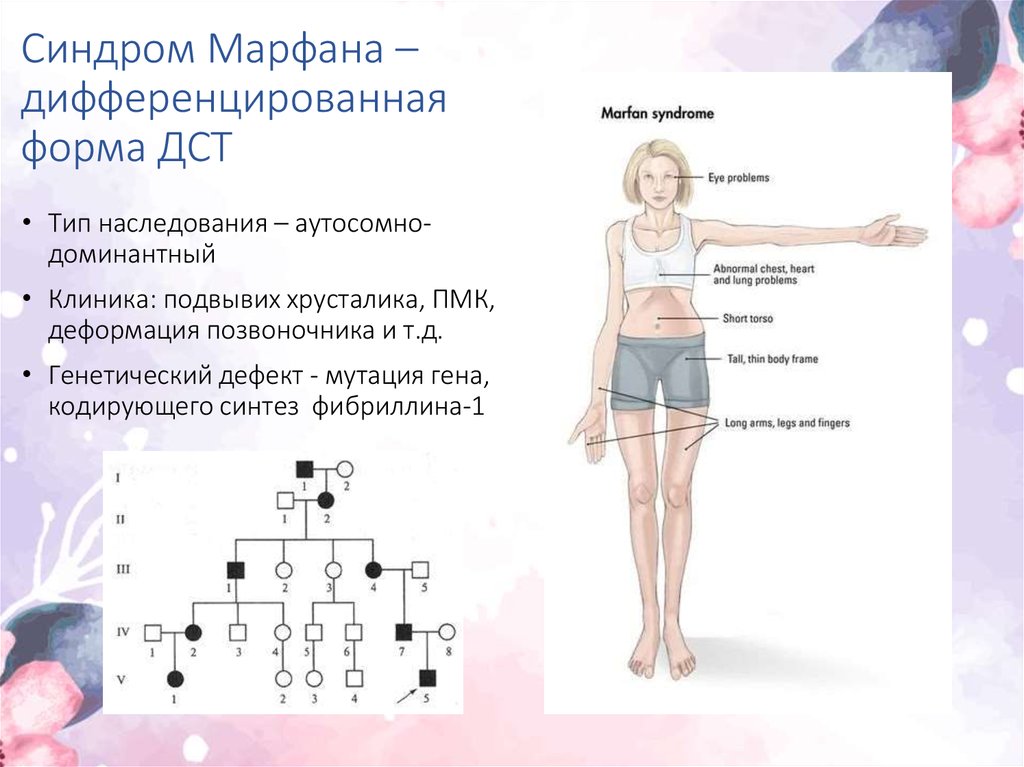 Дисплазия тканей. Тип наследования Марфана. Синдром Марфана Тип наследования. Синдром Марфана Тип наследования генетика. Дисплазия соединительной ткани синдром Марфана.