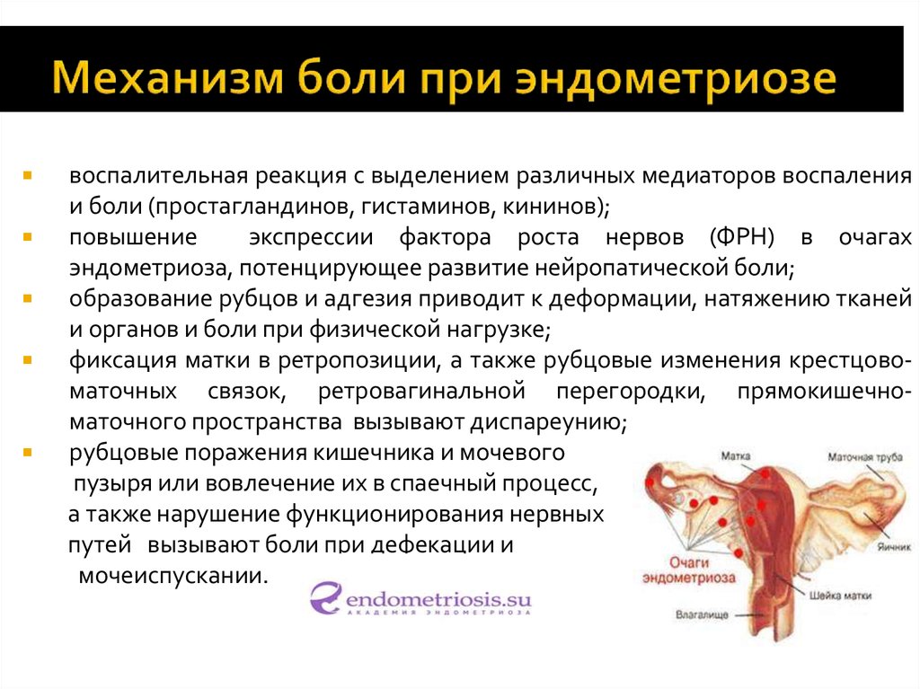 При этом что может. Механизм боли при эндометриозе. Эндометриоз клинические проявления.