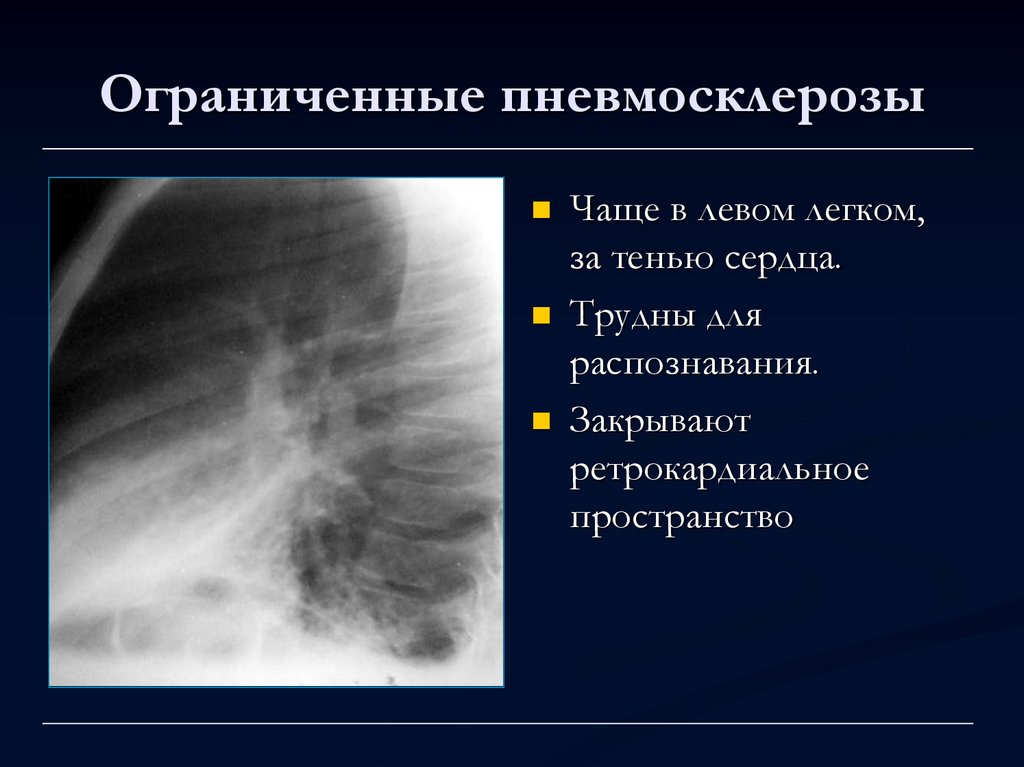 Легочный рисунок с признаками пневмосклероза что