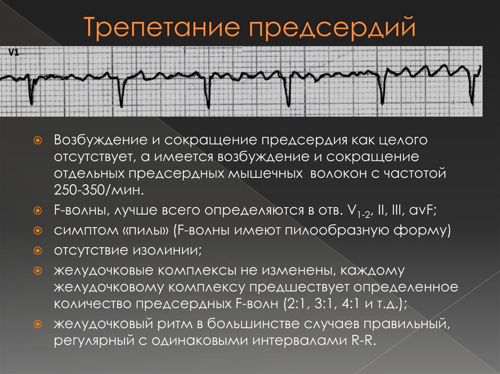 Фибрилляция и трепетание предсердий клиническая картина