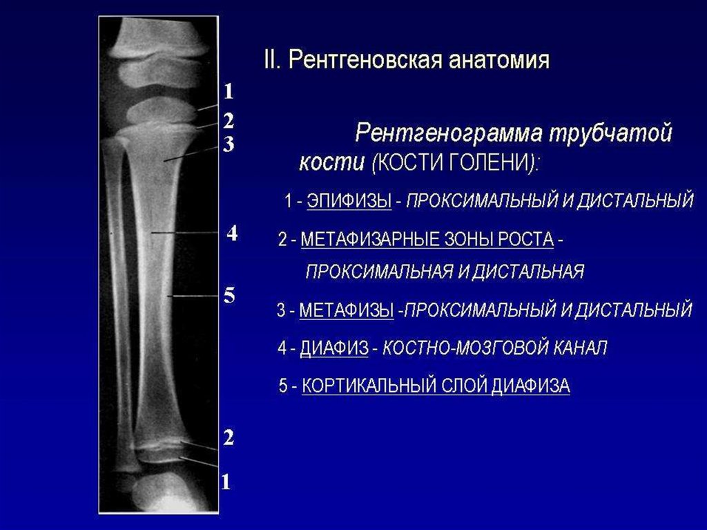 Пластина роста. Строение большеберцовой кости рентген. Анатомия большеберцовой кости рентген. Анатомия малоберцовой кости рентген. Строение трубчатых костей рентген.