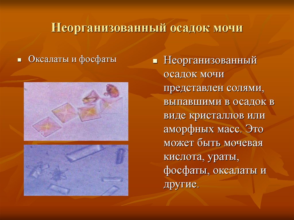 Соли кислой мочи фото