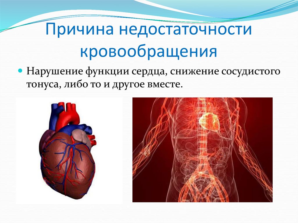 Нарушение кровотока. Нарушение кровообращения. Патология кровообращения. Нарушено кровообращение. Нарушение кровообращения и лимфообращения.